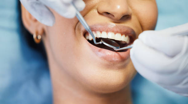 Best Emergency Tooth Extraction in Buffalo, MO